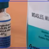 Toledo doctors advise calling ahead before seeking care for measles